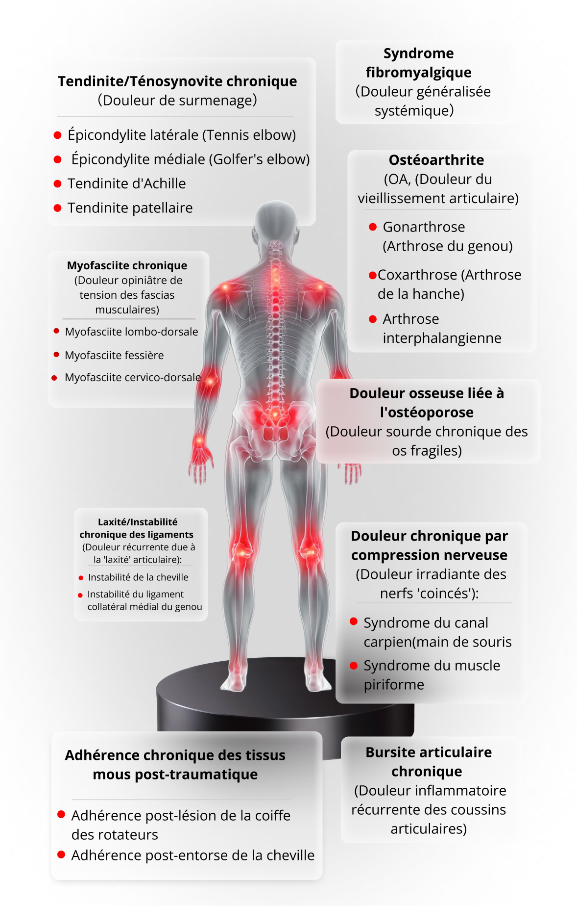 Carte des douleurs chroniques traitées par ULTRIIX S1