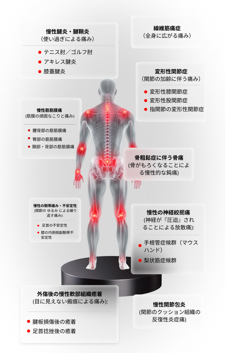ULTRIIX S1 - スポーツ損傷と慢性疼痛向けに設計された