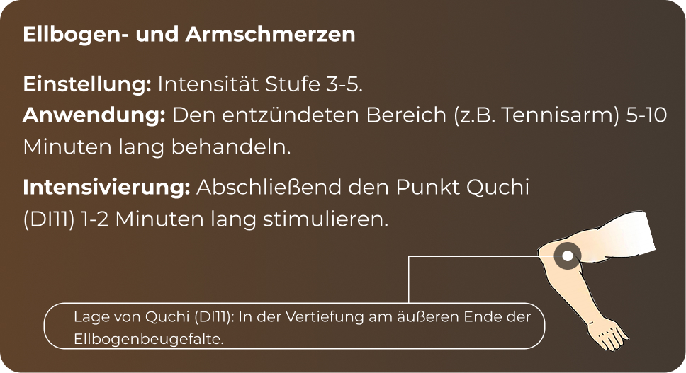 Referenzpunkte Ellbogen