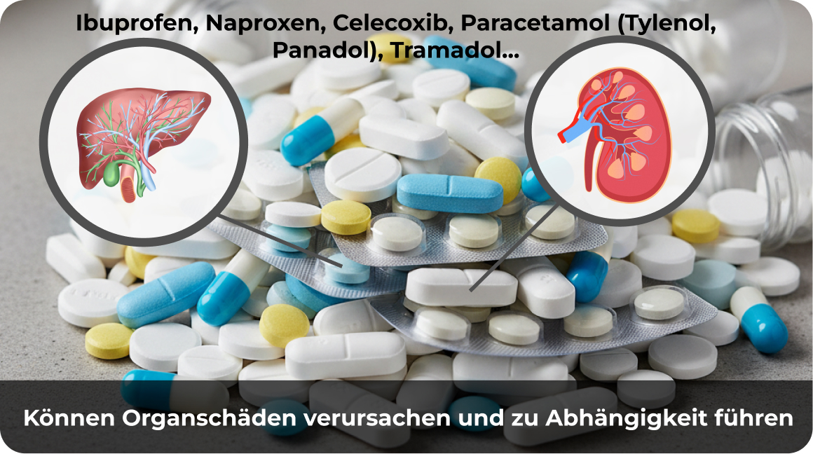 Ibuprofen und andere gängige Schmerzmittel