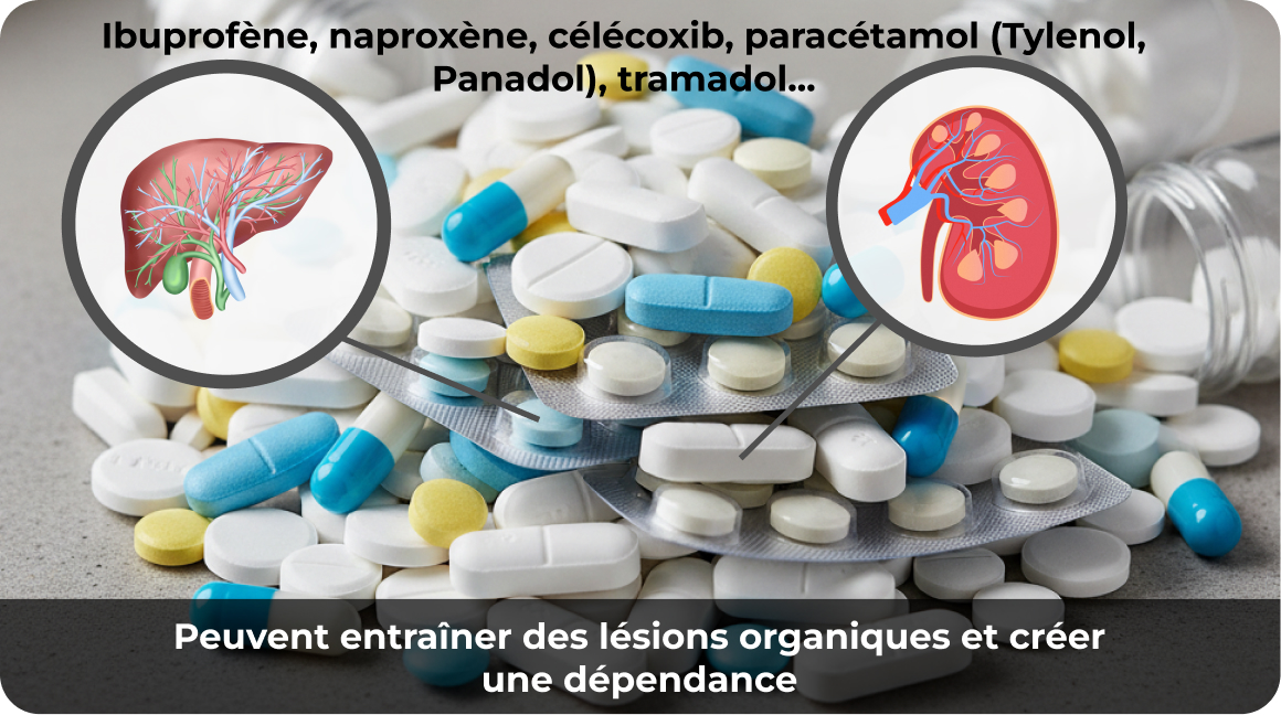 Ibuprofène et autres analgésiques courants