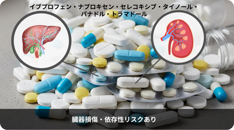 布洛芬等一般的鎮痛藥物