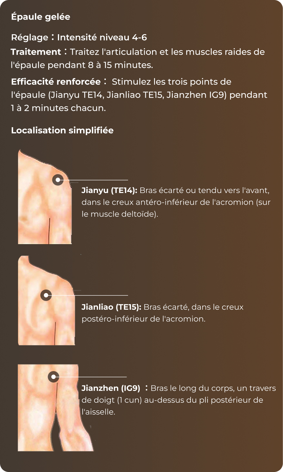 Référence des points d'acupuncture de l'épaule