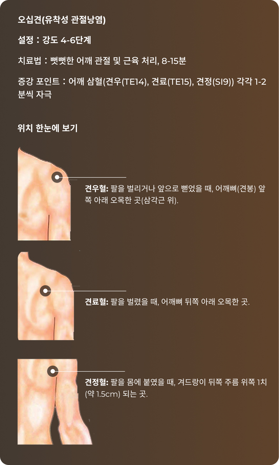 어깨 혈자리 참고